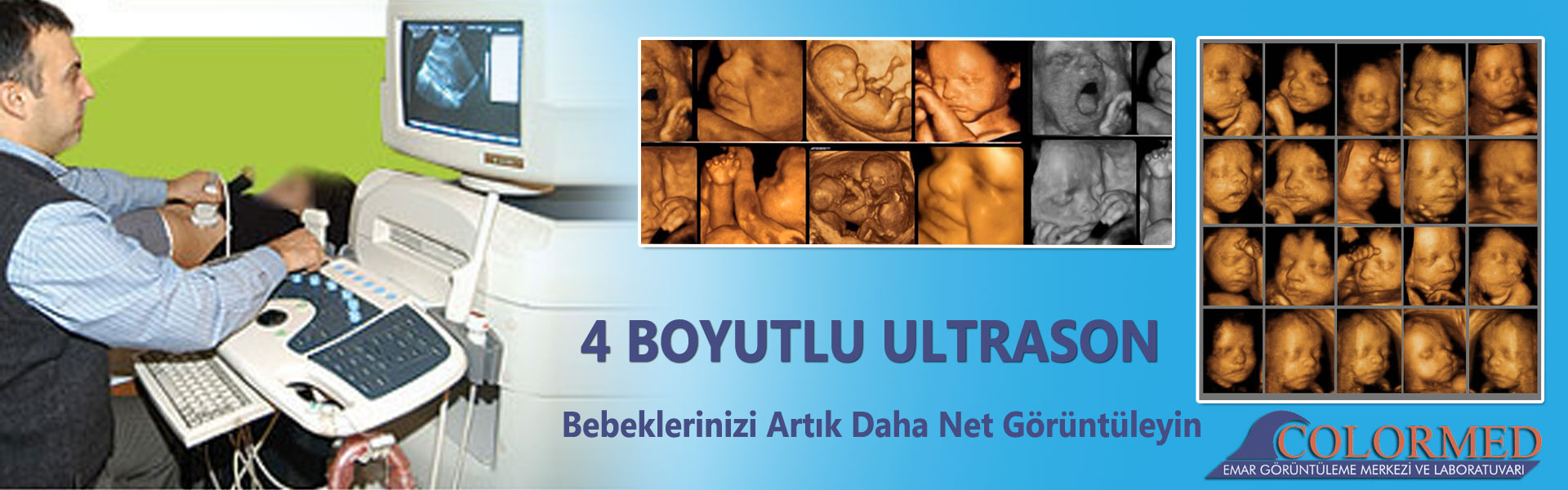 4-boyutlu-ultrason-hizmeti