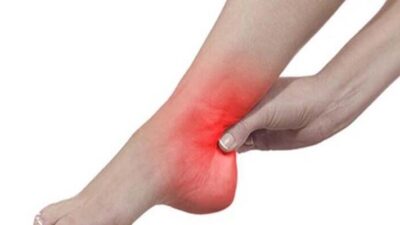 Topuk ağrısı neden olur?